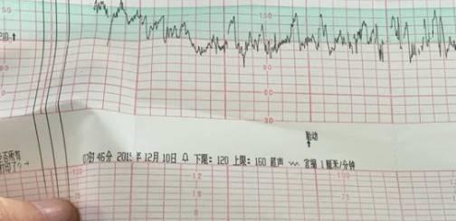 洗衣机胎动过于剧烈，如何处理（解决洗衣机胎动问题的有效方法）