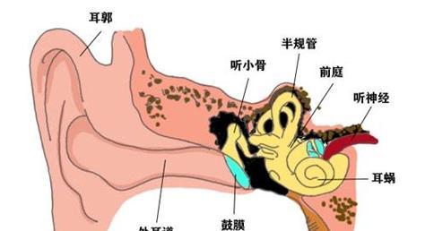 长时间戴电脑耳机声音变小怎么办？有何解决措施？